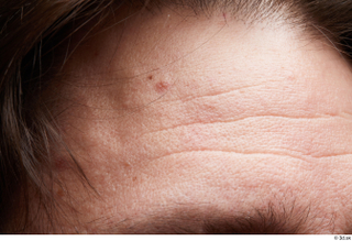  HD Face Skin Arron Cooper face forehead skin pores skin texture wrinkles 0001.jpg